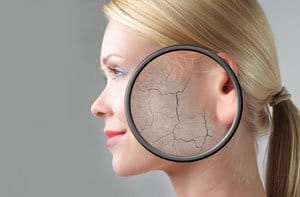 Girl with skin problem