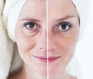 cuidado de la piel procedimiento antienvejecimiento foto de una dama