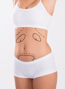 La mitad del torso de mujer con marcas en el estómago en vestido blanco
